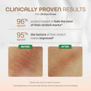 Pigeon Natural Botanical Maternity Set (Free Vanity Pouch)-6