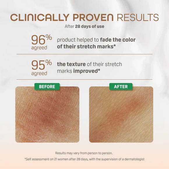 Pigeon Natural Botanical Maternity Set (Free Vanity Pouch)