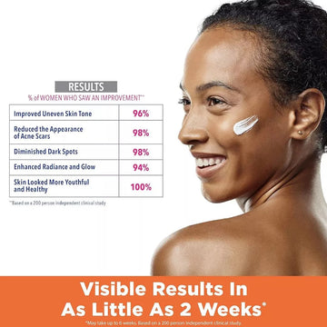 Palmer's Skin Success Anti Dark Spot Series / Cream / Lotion / Serum With Vitamin E - 0